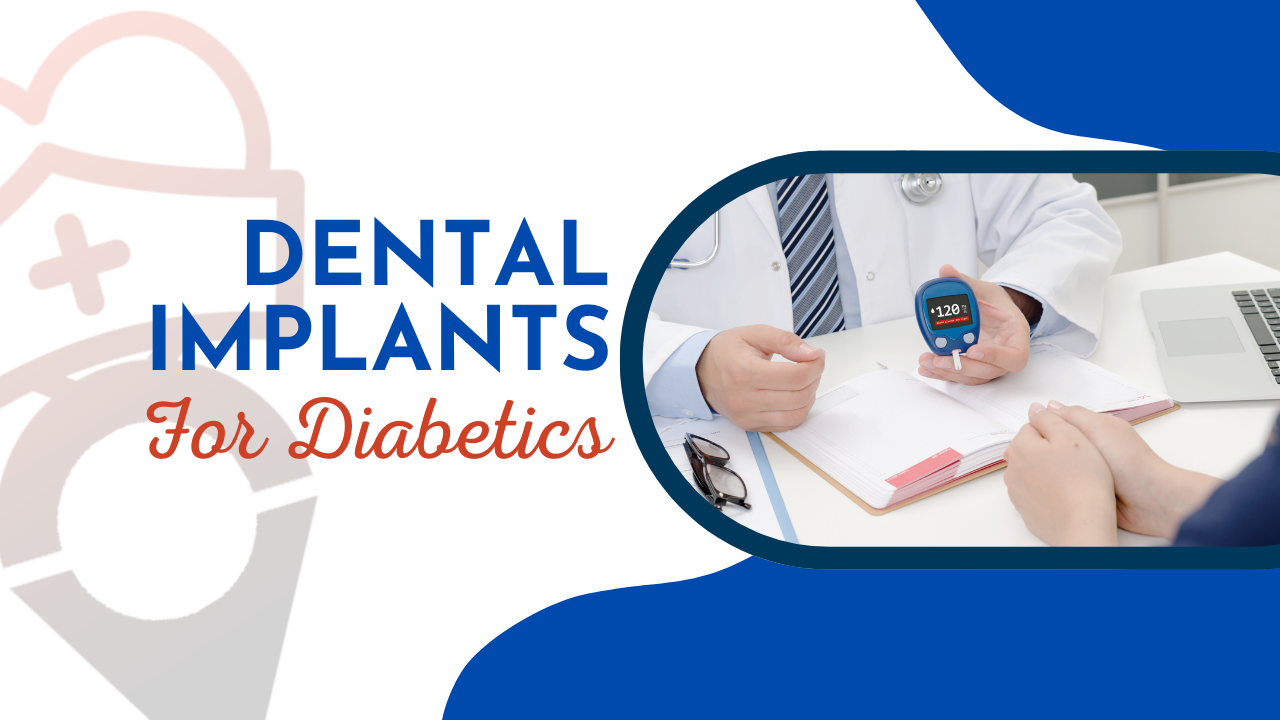 Dental Implants for Diabetics