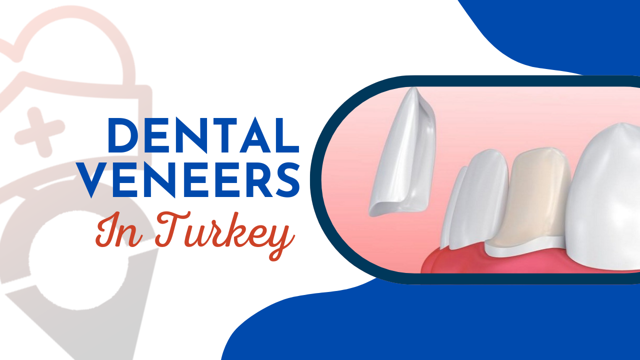 Dental Veneers Turkey