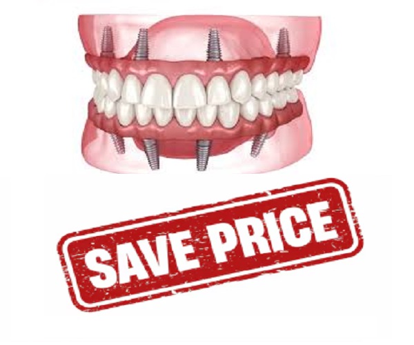 full mouth dental implants turkey price antalya