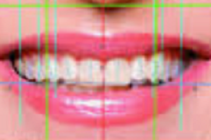 Digital Smile Design